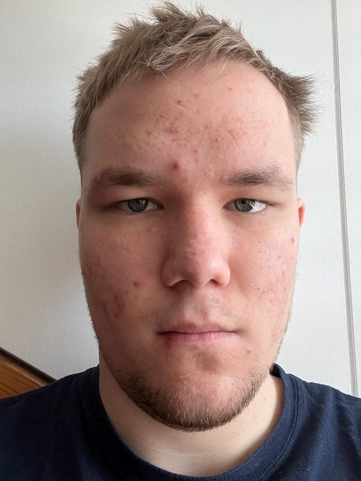 photo placeholder image
